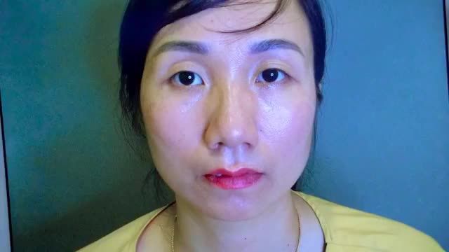 BÁC SĨ CHO CẢ NHÀ CHIÊM NGƯỠNG CA CẮT MÍ KHÓ GIÚP VỊ KHÁCH HÀNG TRẺ TRUNG XINH ĐẸP RẠNG NGỜI