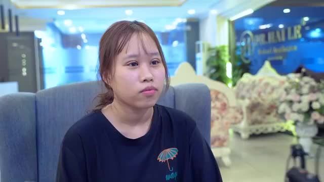 Mời khách hàng theo dõi ca Cắt mí sau 7 ngày thực hiện tuy vẫn còn hơi sưng nề nhưng nếp mí đã bắt đầu vào form tròn đều
