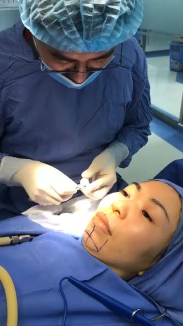 Cận cảnh bác sĩ "thiết kế" dáng cằm V-line khắc phục CẰM NGẮN-LẸM