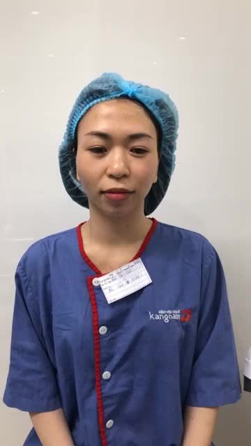 Chiêm ngưỡng dáng cằm V-line đẹp LUNG LINH ngay sau độn cằm