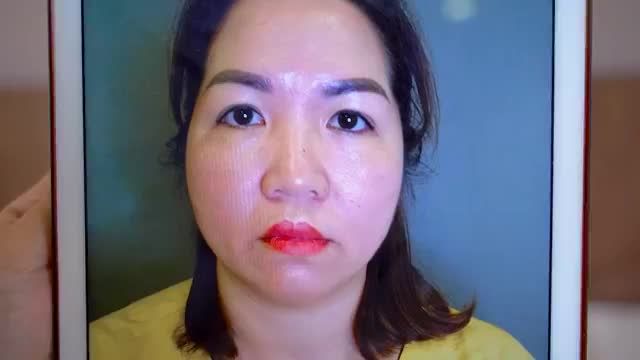 Vị khách hàng trẻ ra 5 - 10 tuổi chỉ sau tiểu phẫu Nâng cung mày mời cả nhà cùng chiêm ngưỡng