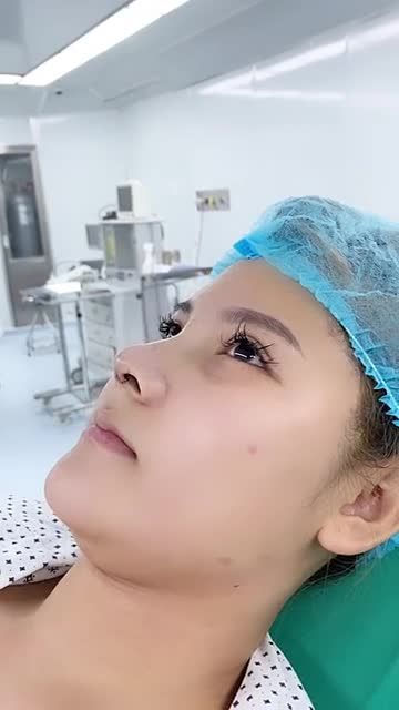 CA MŨI NANOFORM 4D - ĐẸP XUẤT SẮC Hotline: 0931780090