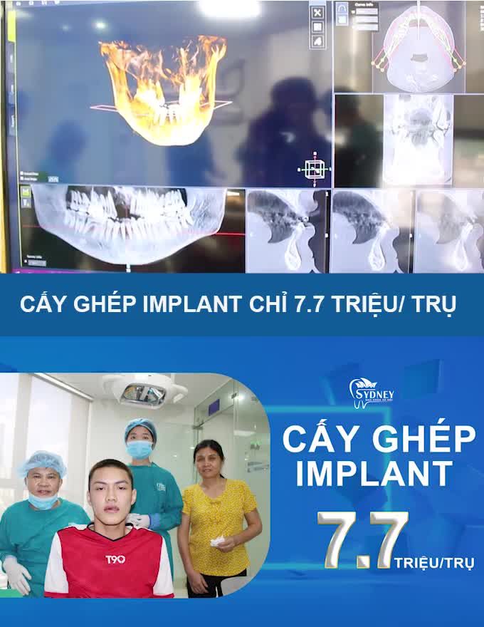 CÓ NHỮNG BIẾN CHỨNG NÀO KHI CẤY GHÉP IMPLANT KHÔNG