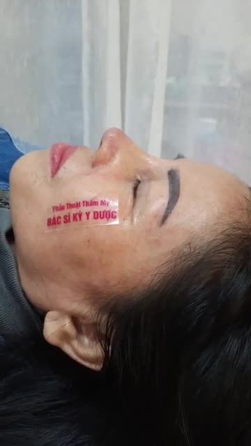 NÂNG MŨI BÁC SĨ KỲ Y DƯỢC