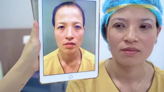 Mắt khó đến mức độ nào Dr.Hải Lê đều có thể khắc phục cho bạn?
