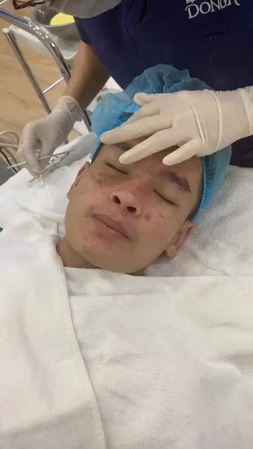 Xử lí một ổ mụn viêm siêu nhiều