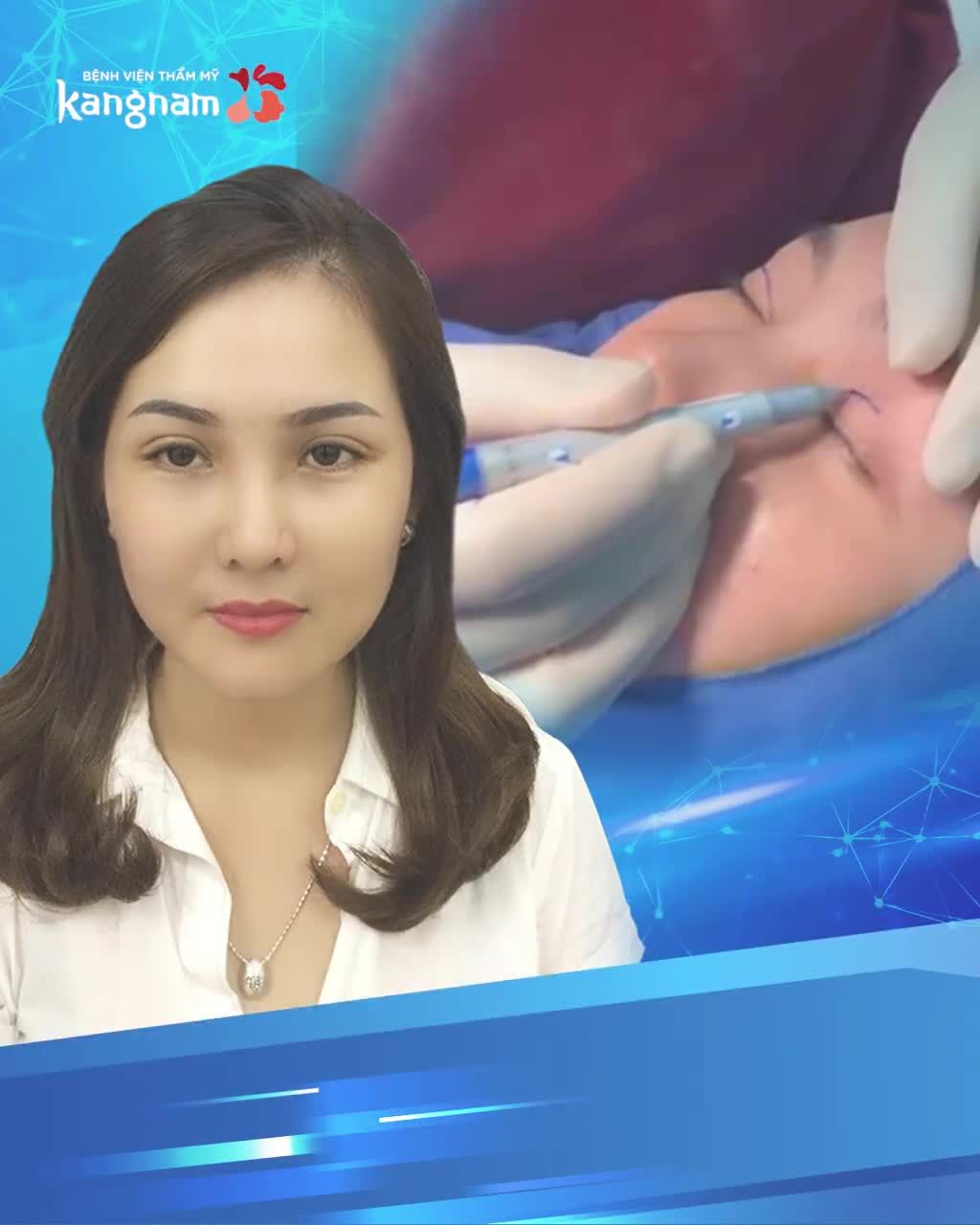 Muốn sửa 1 MÍ MÍ LÓT MÍ LỆCH - Nhưng NGẠI PHẪU THUẬT?