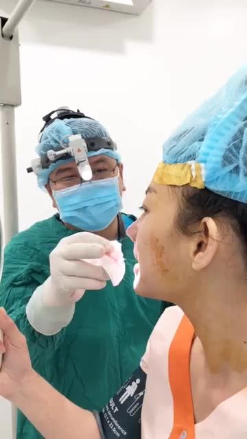Nâng mũi có bị già hơn so với tuổi?