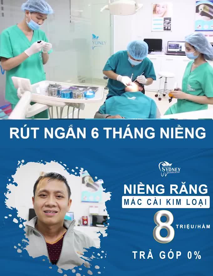NIỀNG RĂNG MẮC CÀI KIM LOẠI - TIẾT KIỆM CHI PHÍ CHO MỌI NGƯỜI