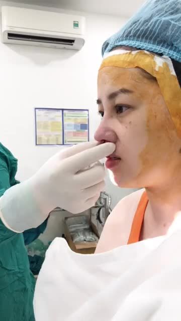 Dáng mũi cực xuất sắc thay đổi toàn bộ gương mặt