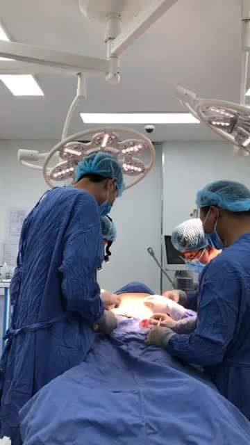 Ca Giải cứu bụng mỡ 20 năm!