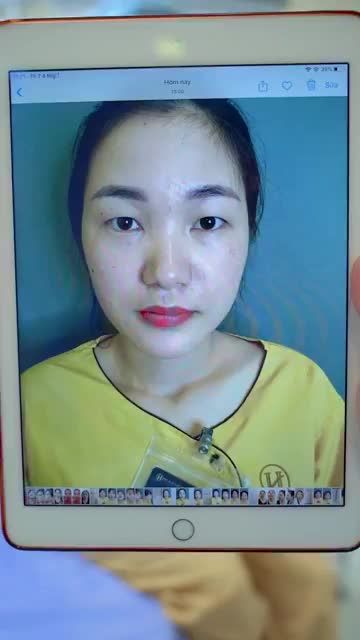 LÀM VIỆC XUYÊN TRƯA ĐỂ MANG ĐẾN KẾT QUẢ NẾP MÍ ĐẸP RẠNG RỠ CHO BẠN KHÁCH HÀNG BÁC SĨ VẪN CẢM THẤY KHÔNG CÓ GÌ MỆT MỎI