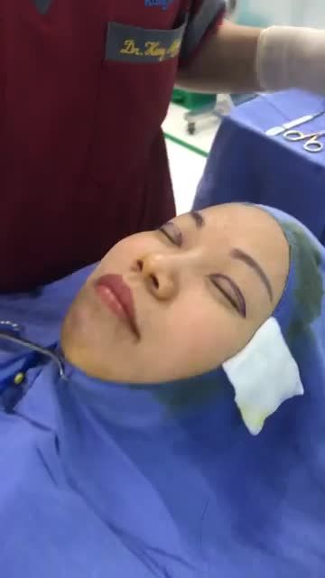 CẮT MÍ LỖI TẠI Spa