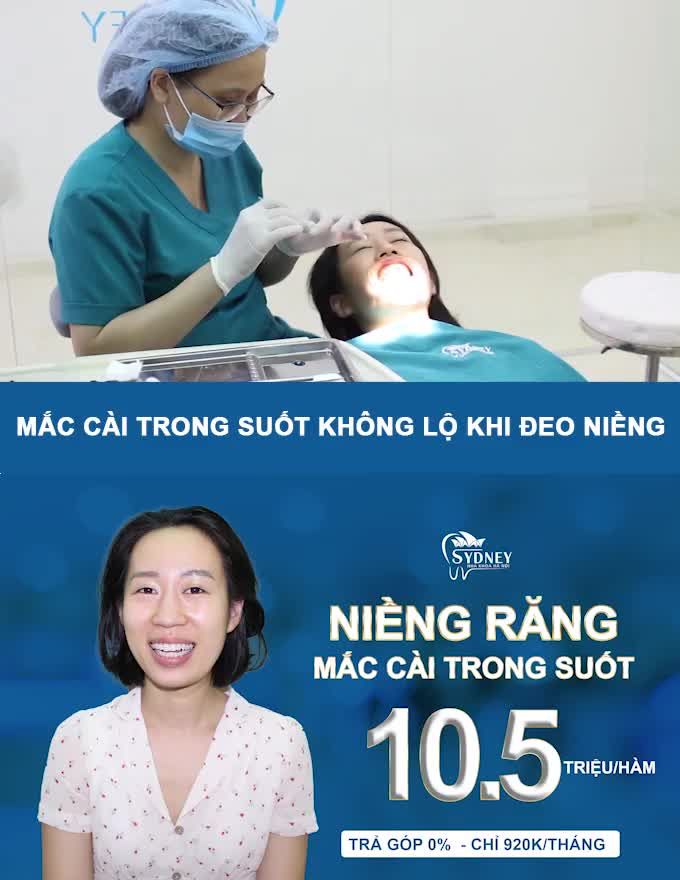 CÓ THỂ NIỀNG RĂNG 1 HÀM HAY KHÔNG