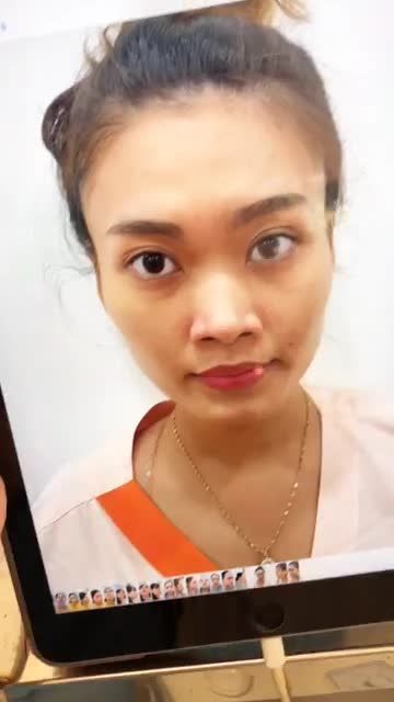 Mũi cấu trúc Surgiform dáng Sline tự nhiên