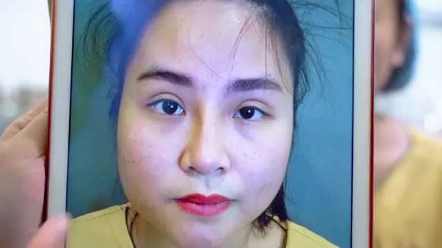 MÍ BIẾN CHỨNG LỖI HỎNG KHIẾN BẠN STRESS VỀ TINH THẦN, MẮC CÁC BỆNH LÝ VỀ MẮT NHƯ ĐAU NHỨC MẮT, MỎI MẮT, CHẢY NƯỚC MẮC...