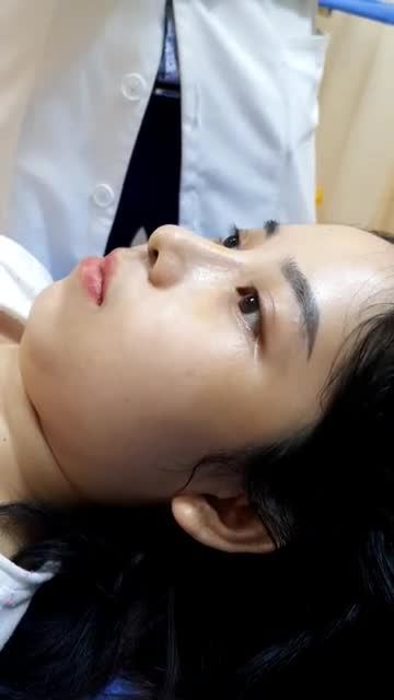 Nâng mũi đẹp tự nhiên chỉ sau 7 ngày, cả nhà có muốn không ạ?
