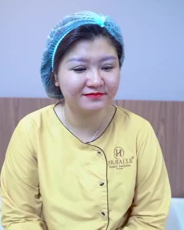 Đẹp xinh rạng rỡ trẻ trung hơn nhờ Cắt mí tại Dr.Hải Lê - Mời quý khách hàng cùng theo dõi