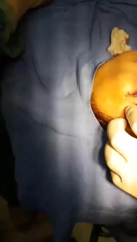 Cùng bác sĩ Kangnam CẤY MỠ THÁI DƯƠNG