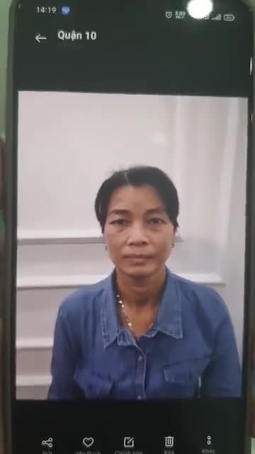 NÂNG MŨI BÁN CẤU TRÚC SLINE VỪA XONG - CHỊ KHÁCH TRẺ RA 3 TUỔI