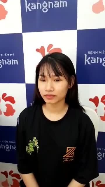 7 ngày sau cắt chỉ! Mắt 2 mí đều tự nhiên quá ạ