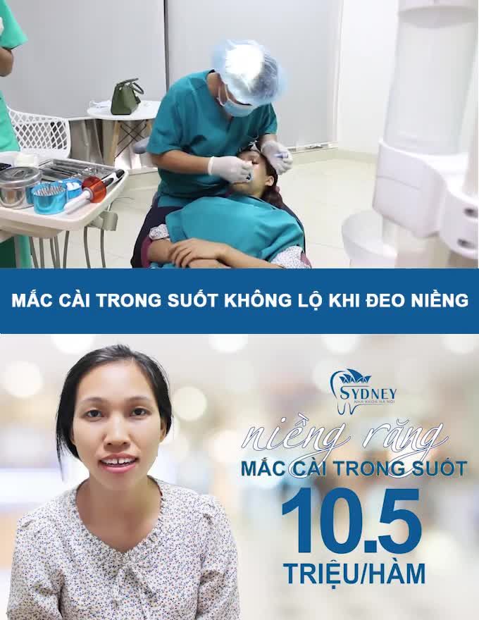 CÓ TỚI HƠN 40% KHÁCH HÀNG NIỀNG RĂNG GẶP TÌNH TRẠNG HÔ