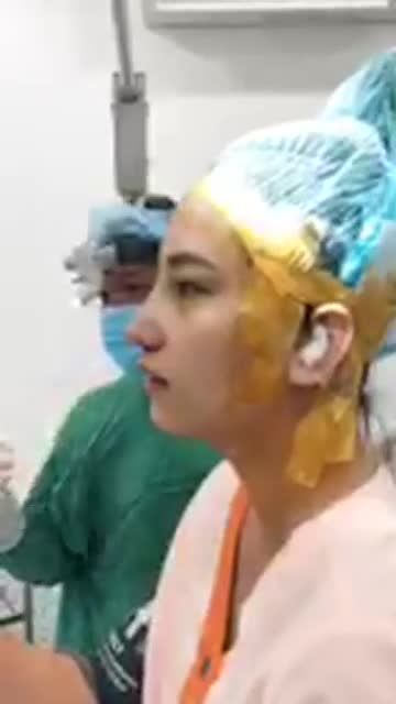 Sóng mũi thấp - đầu mũi to - cánh mũi bè