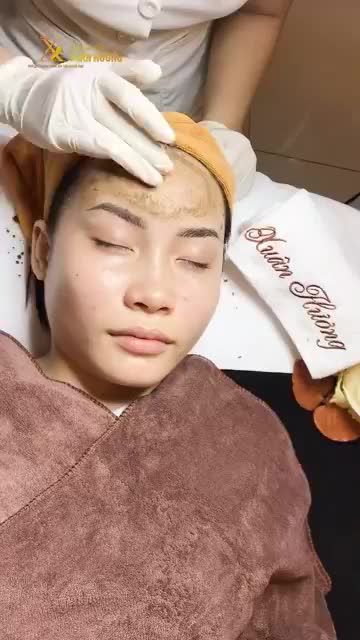 TRỊ MỤN SAI CÁCH ĐỂ LẠI THÂM MỤN TRÊN DA, KHÁCH HÀNG CẤY KHOÁNG TẠI TMV XUÂN HƯƠNG HỒI PHỤC DA NGAY LẬP TỨC