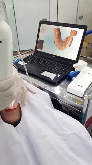 Niềng răng khay trong đúng chuẩn - Phải chọn đúng công nghệ