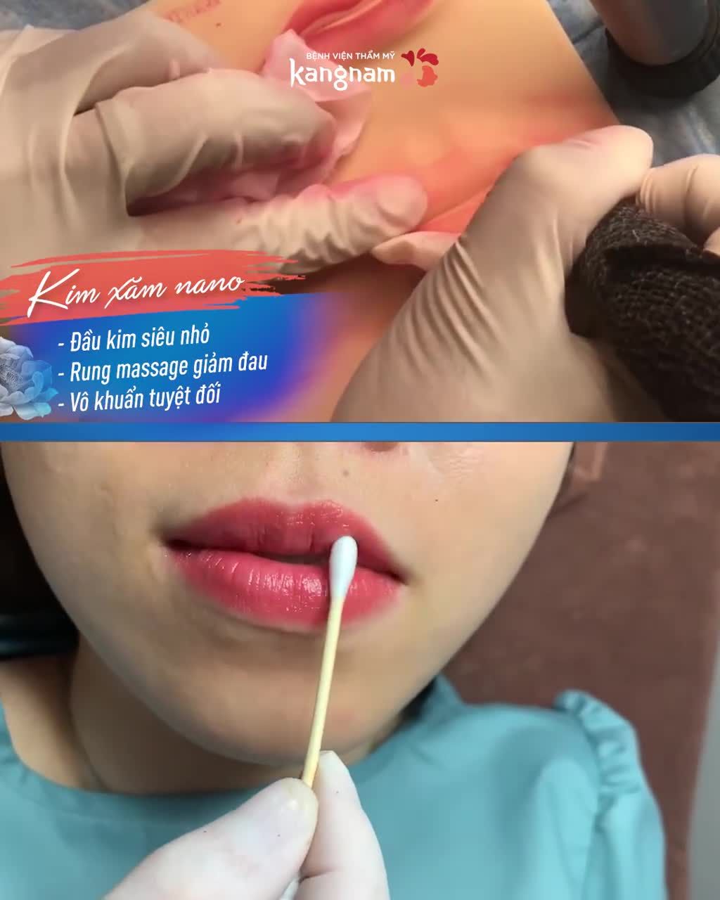 Công nghệ phun môi Nano - Tinh hoa của phun xăm thẩm mỹ hiện đại