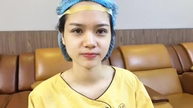Cắt mí tại Dr.Hải Lê khách hàng thường có nhận xét chung: Rất ít đau và bầm tím, mí sau làm form tròn đều, rất hài lòng, rất ưng ý..