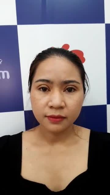 Mí to tròn rõ nét quá! Mới chỉ sau 6 ngày CẮT MÍ thôi ạ