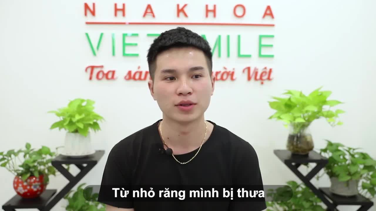 Dán sứ veneer đóng khe thưa chính là giải pháp hoàn hảo được rất nhiều khách hàng lựa chọn tại VIET SMILE