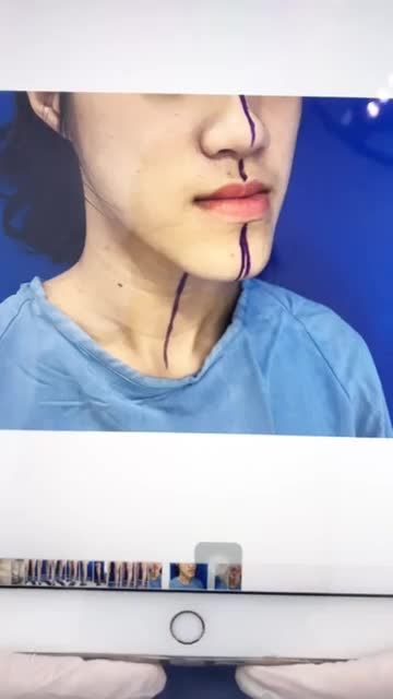 kết quả sau 120 phút giải cứu "MẶT LƯỠI LIỀM"
