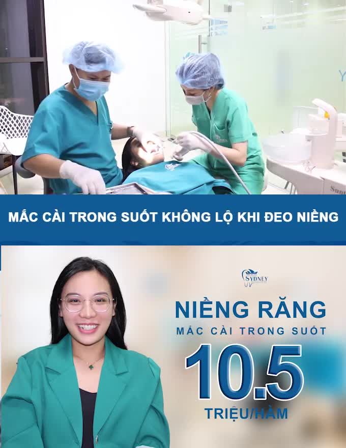 3 PHƯƠNG PHÁP NIỀNG RĂNG CHO NGƯỜI ĐI LÀM