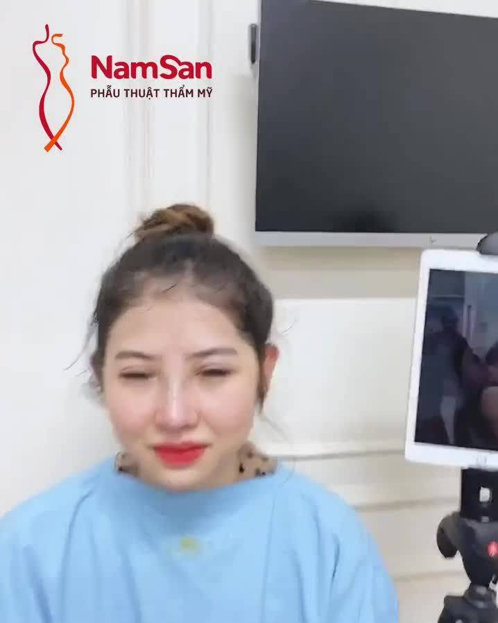NÂNG MŨI SLINE SỤN TAI ĐA LỚP