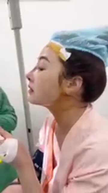 Niềm vui với dáng mũi cấu trúc xuất sắc sau 7 năm nâng mũi nhân tạo