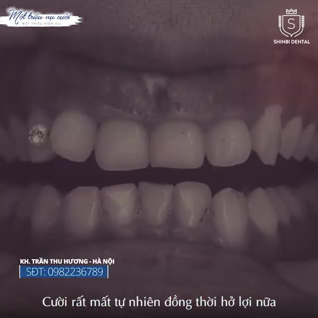 NỤ CƯỜI TỰ TIN - TUYÊN NGÔN KHÔNG LỜI VỀ VẺ ĐẸP CỦA NGƯỜI PHỤ NỮ HIỆN ĐẠI