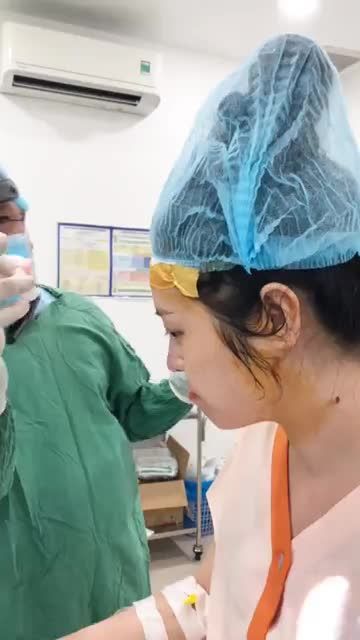 Cải thiện SÓNG MŨI THẤP - MŨI GỒ NHẸ - DA MŨI MỎNG