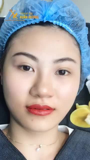 SẮC MÔI MỜ NHẠT, KHUÔN MÔI KHÔNG RÕ KHÁCH HÀNG PHUN MÔI TẠI XUÂN HƯƠNG VÀ BẤT NGỜ VỚI KẾT QUẢ SAU 40 PHÚT