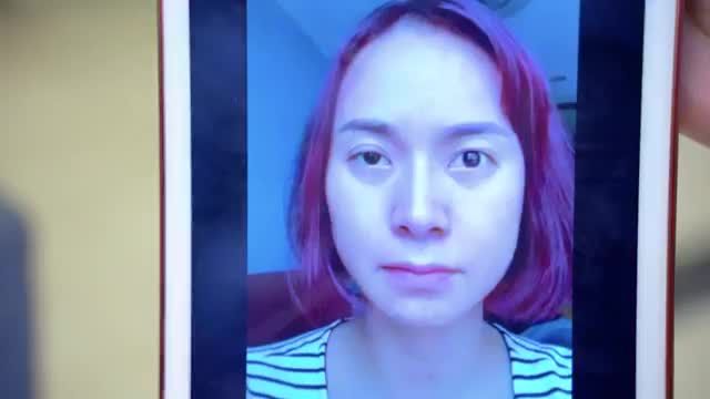TRẢI LÒNG của vị khách hàng Diệu Hương sau Cắt Mí lỗi hỏng 4 lần ở cơ sở không uy tín và sửa lần thứ 5 tại Dr.Hải Lê thành công ngoài sự mong đợi