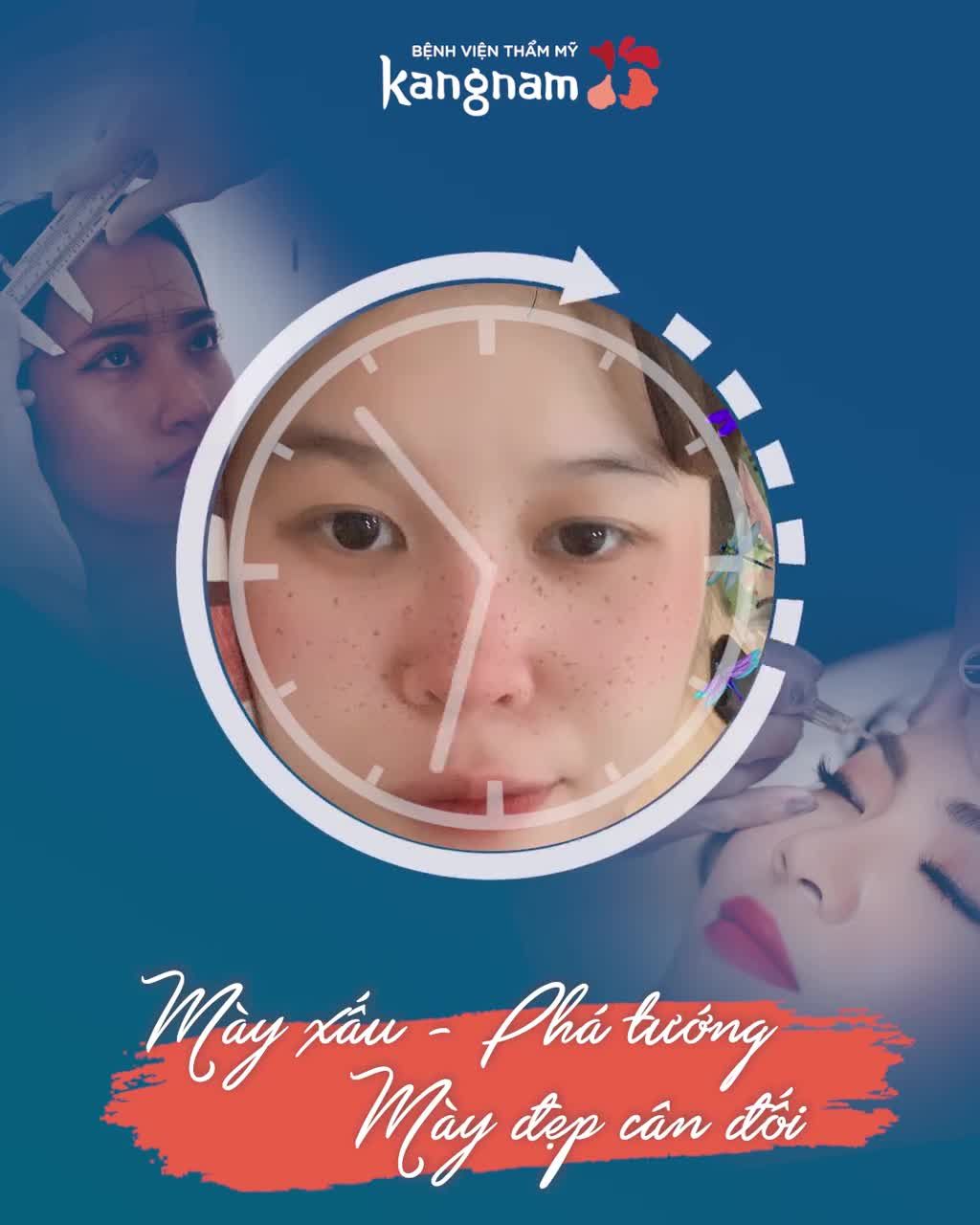 Đuôi mày ngắn - Lông mày thưa - Mày mảnh như đường chỉ