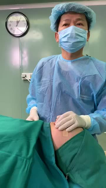 Bác sĩ Tú Dung GIẢI CỨU MŨI XẤU, TO, THÔ bằng kỹ thuật Nâng mũi sụn sườn phức tạp