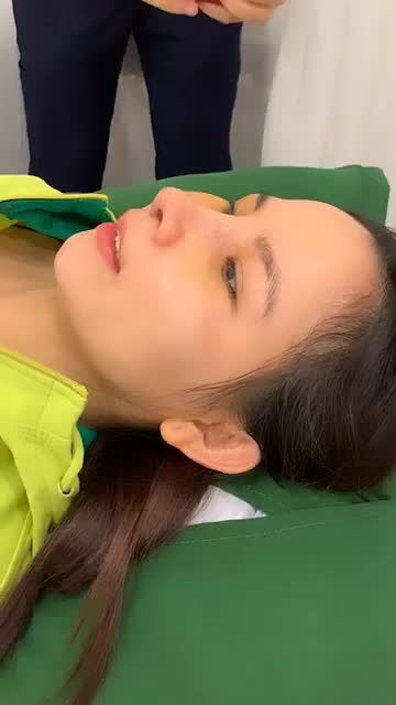 CẬN CẢNH DÁNG MŨI CẤU TRÚC TÁI KHÁM SAU 5 NGÀY