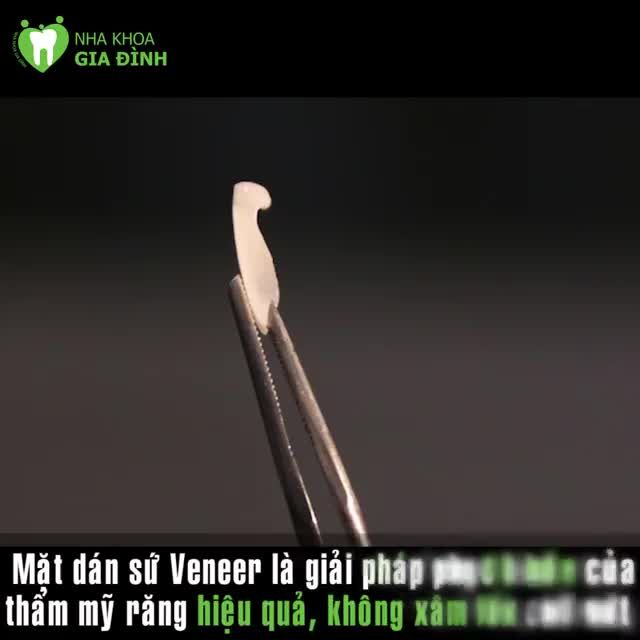 DÁN SỨ VENEER BAO LÂU THÌ PHẢI THAY LẠI?