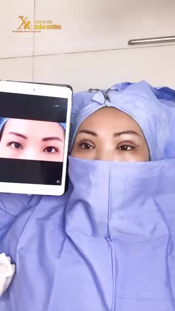 MÍ MẮT ĐẸP THÌ NHAN SẮC XINH HƠN 10 PHẦN