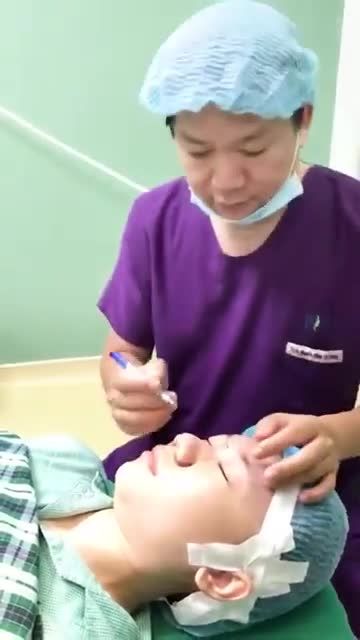 Bác sĩ Tú Dung đo vẽ nâng mũi sụn sườn phức tạp