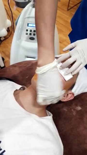 Trị mụn chỉ với 99K Trời ơi tin được không??