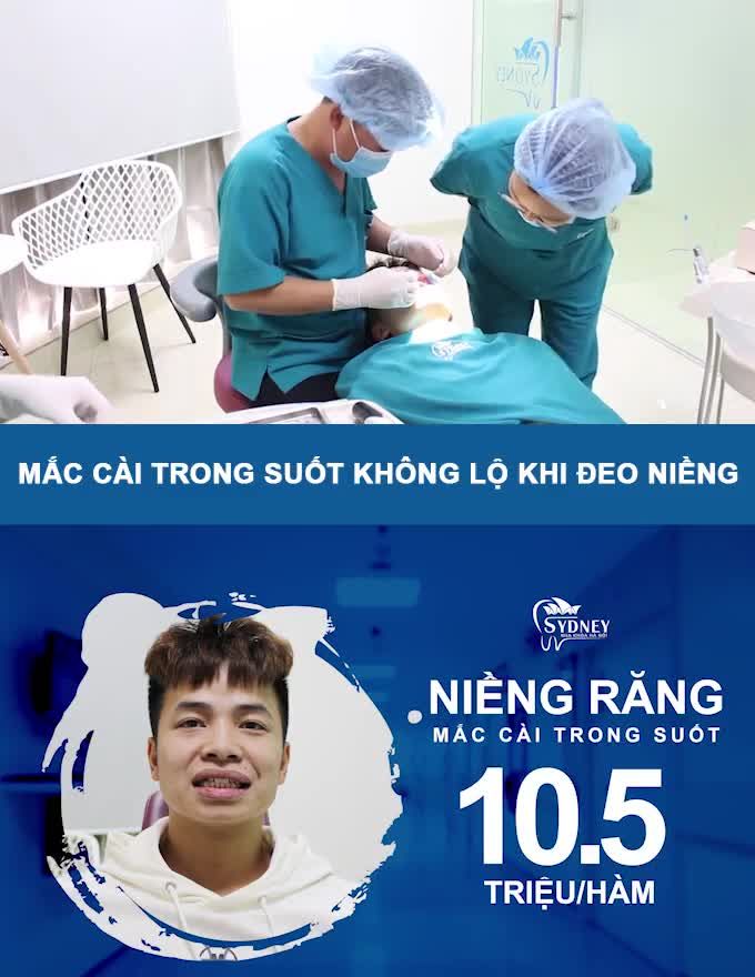 CHỈNH NHA THẨM MĨ LÀ GÌ