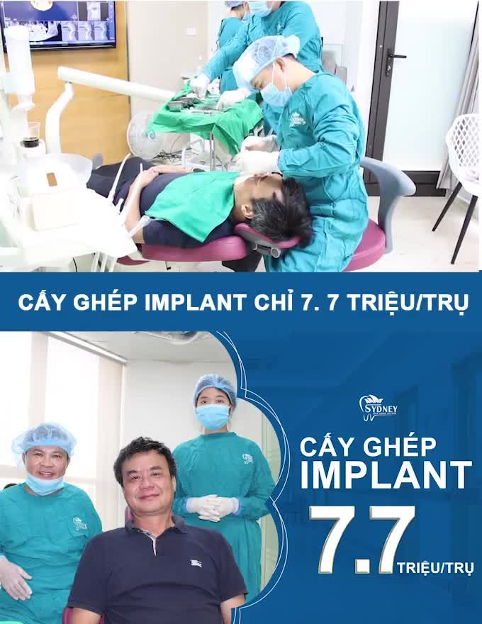 CẤY GHÉP IMPLANT AN TOÀN TẠI NHA KHOA HÀ NỘI SYDNEY